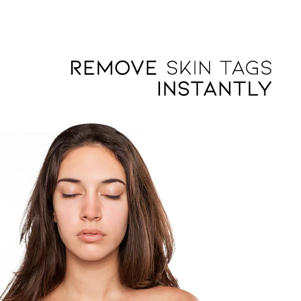 WipeOff Tags & Mole Remover | 🔥Buy 1 Get 1 Free🔥