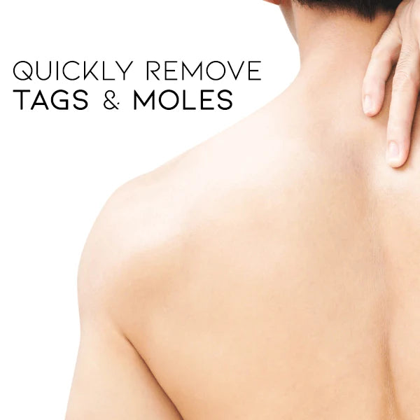 WipeOff Tags & Mole Remover | 🔥Buy 1 Get 1 Free🔥