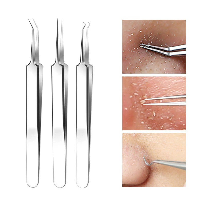 💓Last day discount💥Medical grade blackhead cell clip tool set
