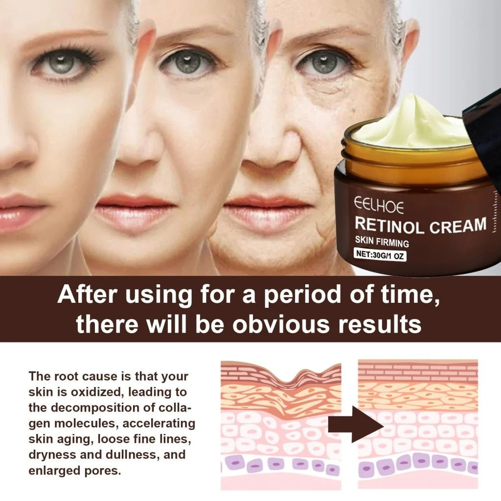 EELHOE Retinol Cream – Youthful, Radiant Skin Made Simple (Buy 1 Get 1 Free 🔥🔥)