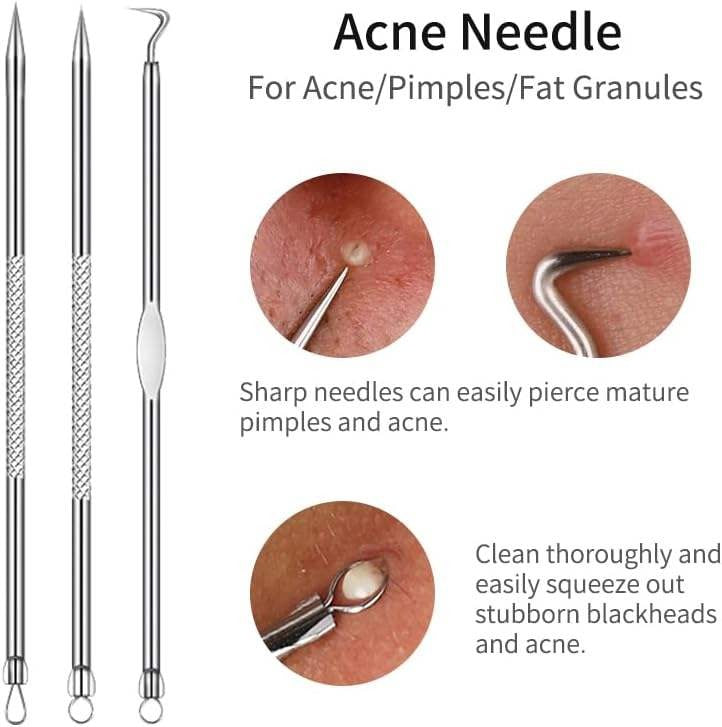 💓Last day discount💥Medical grade blackhead cell clip tool set