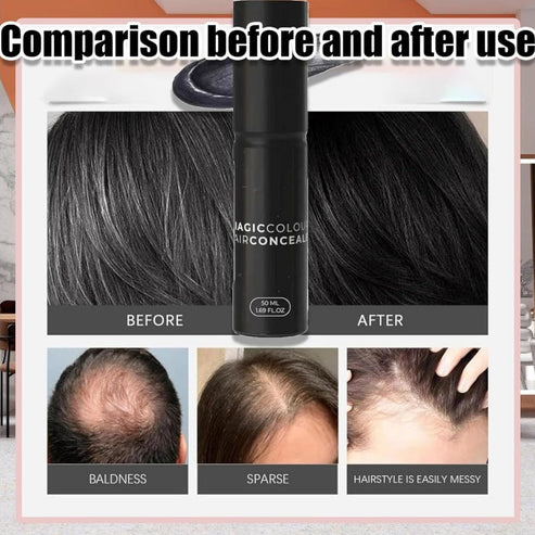 Scalp Concealer for Fuller, Natural-Looking Hair (BUY 1 GET 1 FREE ) Secondary image