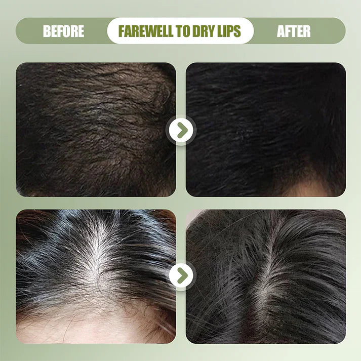 🧼 Strengthening Solid Shampoo – Botanical Formula for Balanced Scalp, Volume & Less Breakage | 🔥Buy 1 Get 1 Free 🔥