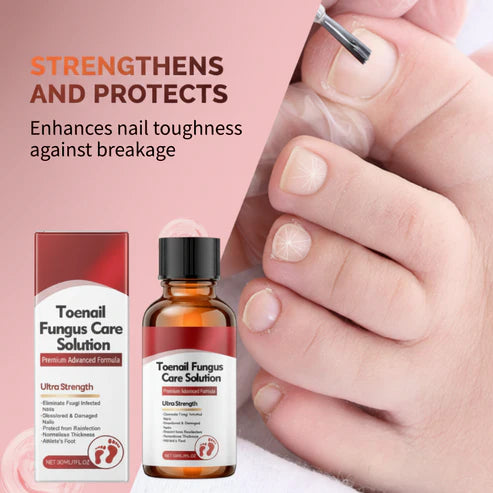 🔥Buy 1 Get 1 Free🔥 Nail repair essence for damaged nails